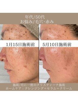 マール(MARL.)/毛穴・化粧崩れ/お悩み改善へ♪