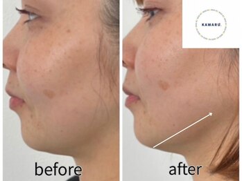 カワル(KAWARU)/レモンボトル