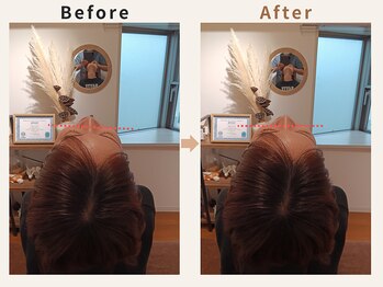 ハリデイズ/20代-首こり、むくみ