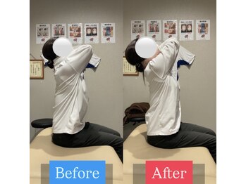 ナオル整体 宮崎院(NAORU整体)/30代女性施術事例【姿勢改善】