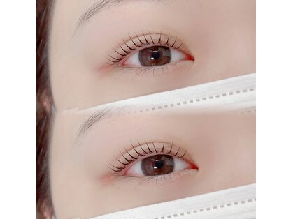 ジッピーオブヘア アイエク(Zippy of hair iEQ)の写真