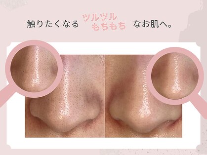 美シェリ(美Cheri)の写真