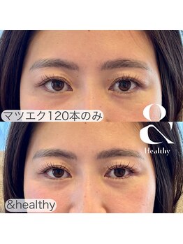 リム(Lim)/【新導入】アンドヘルシー