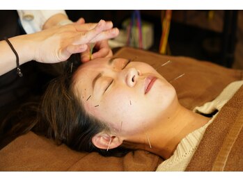 ほねごり接骨院 はりきゅう院 町田滝の沢院/【小顔/肌荒れ/くすみ】美容鍼