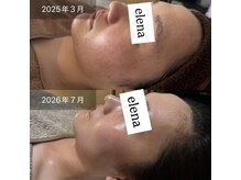 エレナ(Elena)の雰囲気（ニキビケアに特化したサロンです。精一杯サポートさせて頂きます）