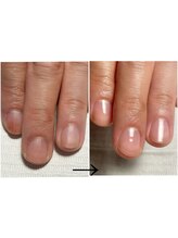 エンネ(enne)/ハンドケア