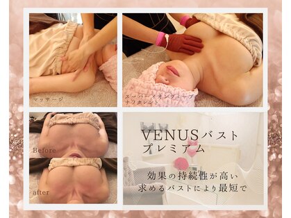 ヴィーナス(Venus)の写真