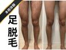 メンズ 本格★あし脱毛 初回 6600円 【剃毛+美肌ケア付】