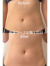トレミー(Treme)/ダイエットコース