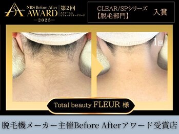 フルール(FLEUR)/脱毛機メーカー公認の脱毛効果☆