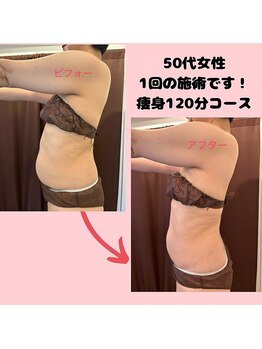 カオン(kaon)/マシン×ハンド1回での施術