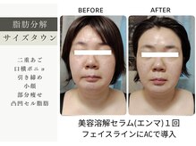 ティアス(t-us)の雰囲気（脂肪分解(写真)とふっくらハリを出す脂肪増強美容液で凸凹を解消）