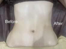 アクアリジェ/痩身リンパ　ウエスト