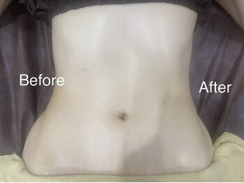 アクアリジェ/痩身リンパ　ウエスト