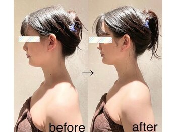 ビュール 銀座(BeauL)/小顔ケア