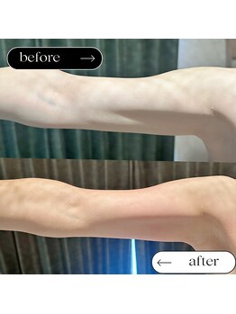 プライベートサロン ヴィヴィアン(Vivian)/キャビマックス痩身