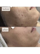 ヴェルシック(Belchic)/男性のお肌も見られています