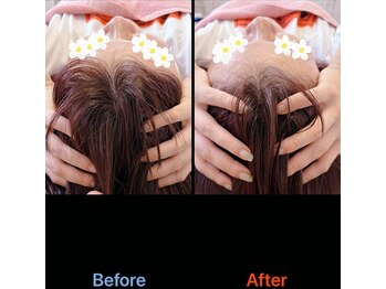 美容矯正サロン レレポノ(LELEPONO)/