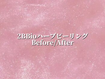 アブニールブリヨン/2BBioハーブピーリング/肌質改善