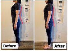 イオム ビューティワーク(IOM BEAUTY WORK)/反り腰がまっすぐに！