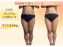 ヨサパーク リボーン(YOSA PARK Reborn)/劇的ビフォーアフター/痩身駒込