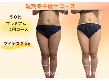 ヨサパーク リボーン(YOSA PARK Reborn)/劇的ビフォーアフター/痩身駒込