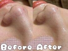 グラシア 倉敷店(Gracia)/お客様の施術事例