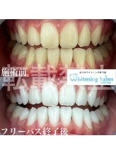 ホワイトニングサロン 福岡天神店/ホワイトニング