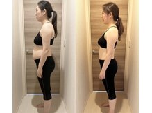 ミミスリム 赤羽(MimiSlim)