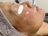 人気メニュー【内側からのWケア付】マイクロニードル&飲むプラセンタ5日分付