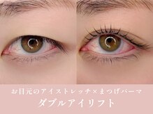 ノンチェ 大阪梅田店(Nonche)/《ダブルアイリフト》