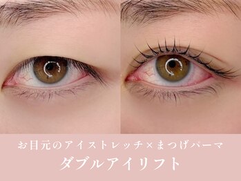 ノンチェ 大阪梅田店(Nonche)/《ダブルアイリフト》