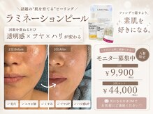 ランファビューティー(蘭花Beauty)/ピーリングモニター募集！