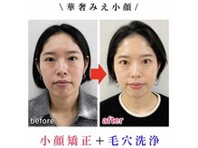 ブプラ 姶良店(BUPURA)