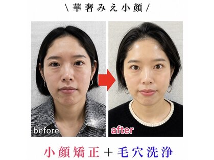 ブプラ 姶良店(BUPURA)の写真