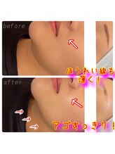 リバイバル(Re:vival)/深夜・早朝もOK♪