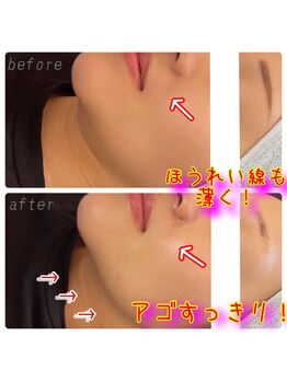 リバイバル(Re:vival)/深夜・早朝もOK♪