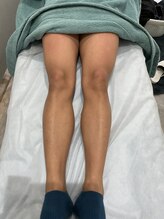 サロン チーク(Salon Cheek)/メンズ脱毛