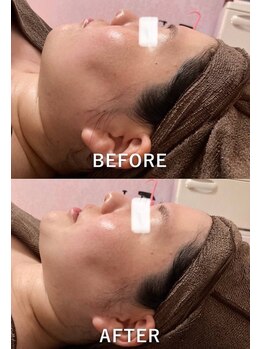 ココチ(KOKOCHI)/フェイシャルリンパコース