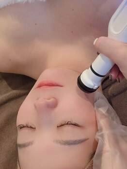 フェイスリオン 三宮店(FaceLion)の写真/【毛穴、肌質改善、ニキビケア、シミケア】究極の肌質改善♪
