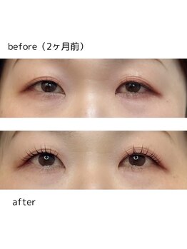 ラ ソレイユ(Le Soleil)/L3リフト/まつげパーマ