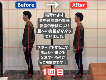 薮下整体院 札幌円山店/30代男性 猫背による腰痛