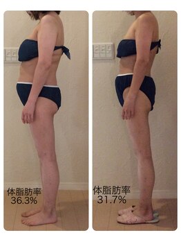 ホロニック ベルサンテ(Holonic Belle Sante)/メディセルハイブリッド