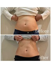 和ごころ本格痩身/