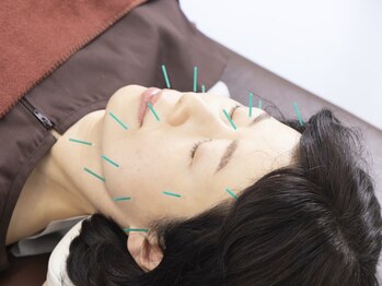 かえで鍼灸整体院の写真/【増え続ける年齢によるお肌悩みに】今話題の美容鍼でターンオーバーを促し、ハリのあるツヤ肌に♪