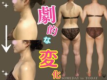 サムデイ プレミアム 心斎橋店(SOMEDAY PREMIUM)