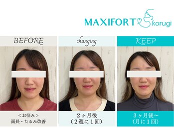 コルギ専門店 マキシフォート 栄店(Maxifort)/お客さまからの感想