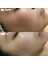 ユイット ルッカ(Huit Lucca)/アクアダーマ