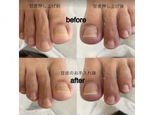 リーシュ 所沢店(RICHE)/フットケア