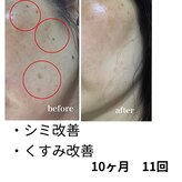 ビープラス(Biplus)